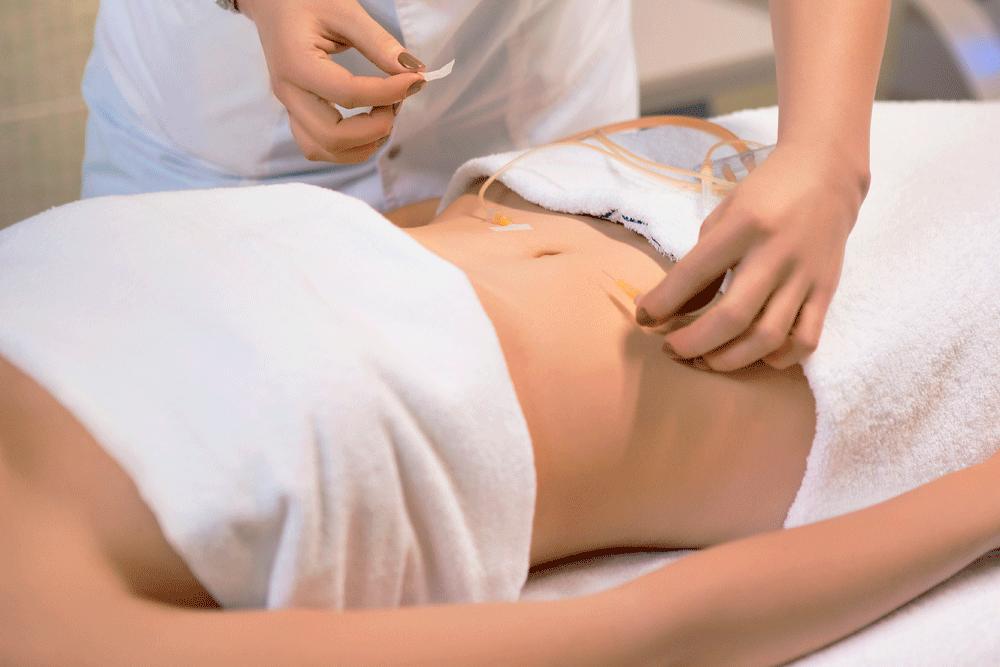 Озонотерапия