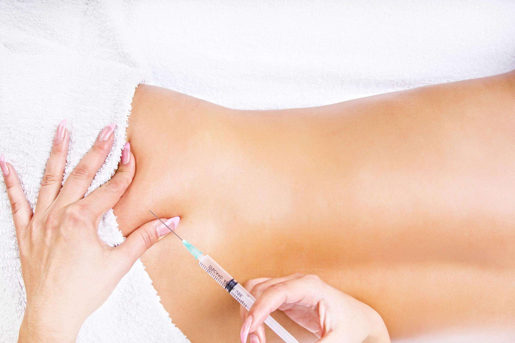 Нейрорефлексофармакопунктура